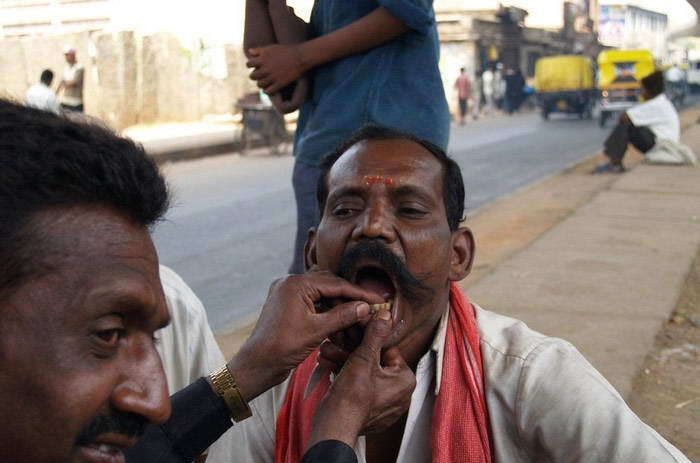 Уличный дантист в Индии (12 фото)