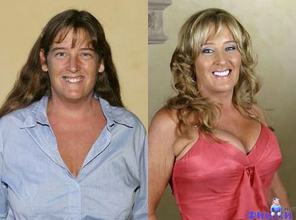 До и после: чудеса красоты (25 фото)