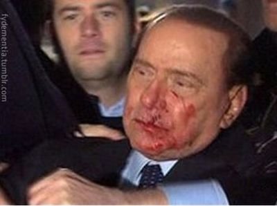 Специальный выпуск!!! Что же на самом деле произошло с Берлускони (5 фото)