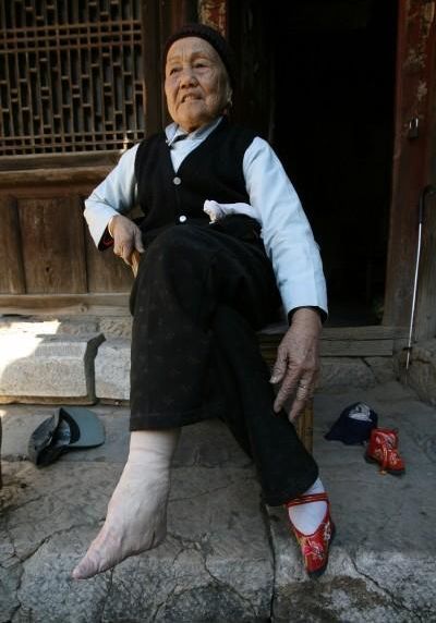 Древняя китайская традиция деформации ступней (7 фото)